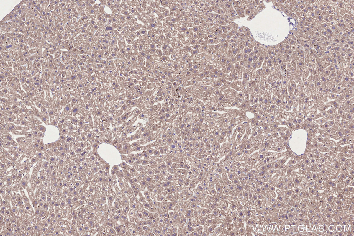 Immunohistochemical analysis of paraffin-embedded mouse liver tissue slide using KHC3294 (CHST4 IHC Kit).