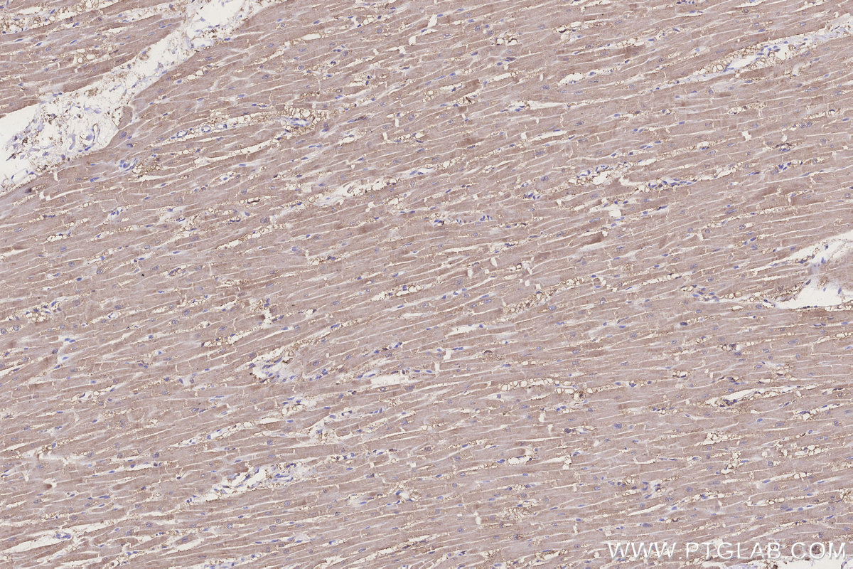 Immunohistochemical analysis of paraffin-embedded human heart tissue slide using KHC3269 (CIAPIN1 IHC Kit).
