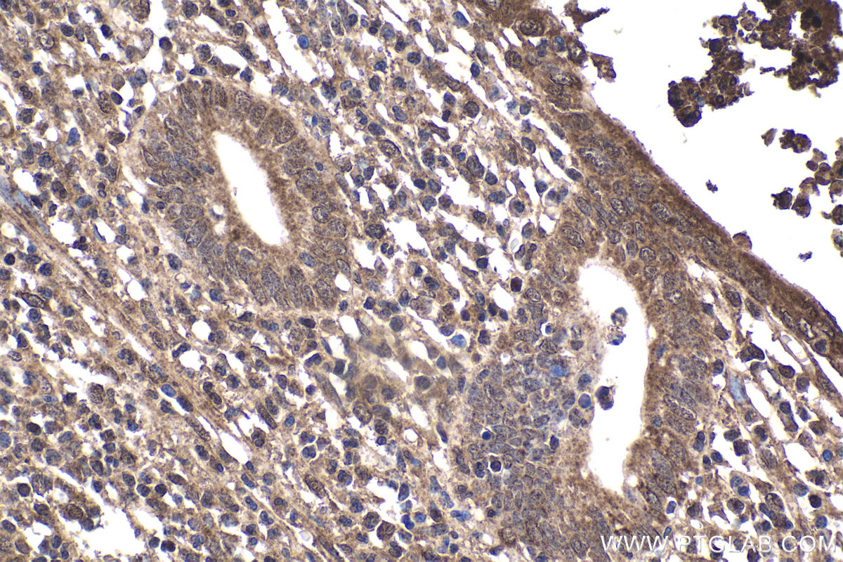 Immunohistochemical analysis of paraffin-embedded human appendicitis tissue slide using KHC1867 (CIDEC IHC Kit).