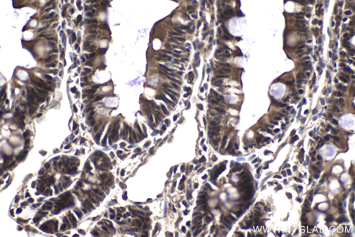 Immunohistochemical analysis of paraffin-embedded rat small intestine tissue slide using KHC1867 (CIDEC IHC Kit).