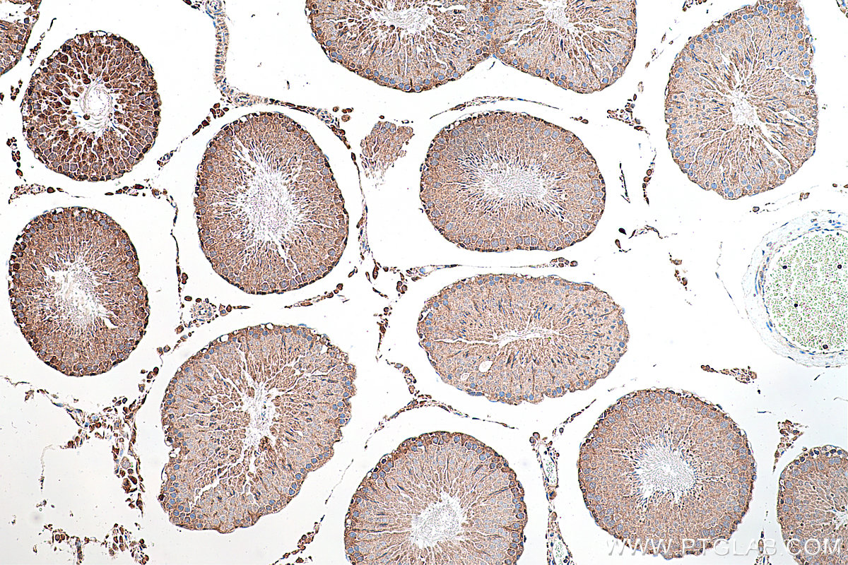 Immunohistochemical analysis of paraffin-embedded rat testis tissue slide using KHC0295 (CITED1 IHC Kit).