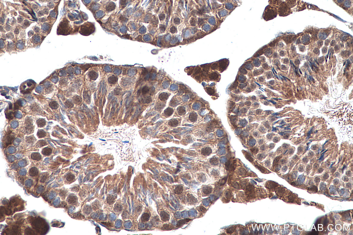 Immunohistochemical analysis of paraffin-embedded mouse testis tissue slide using KHC0295 (CITED1 IHC Kit).