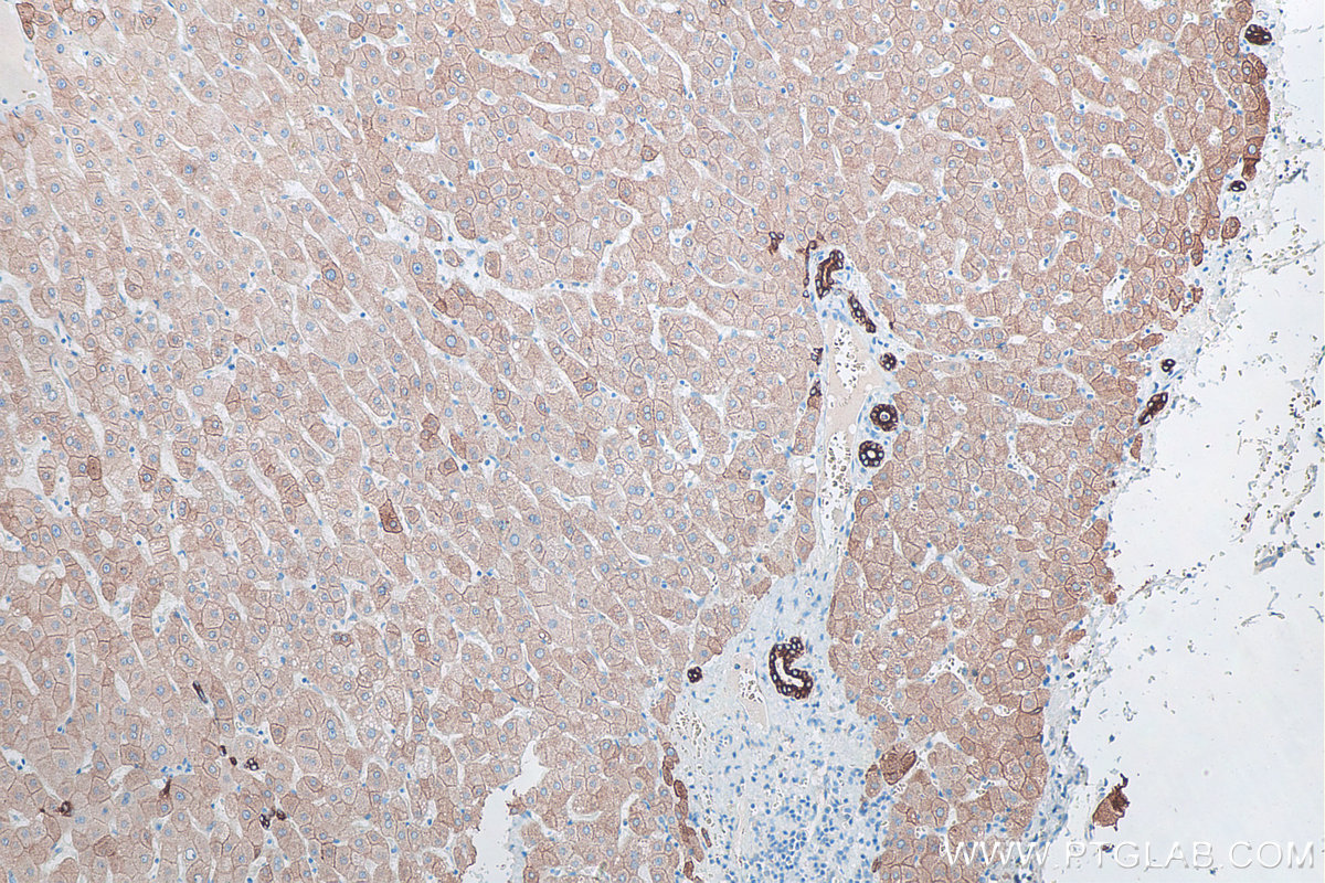 Immunohistochemical analysis of paraffin-embedded human liver tissue slide using KHC0041 (CK8 IHC Kit).