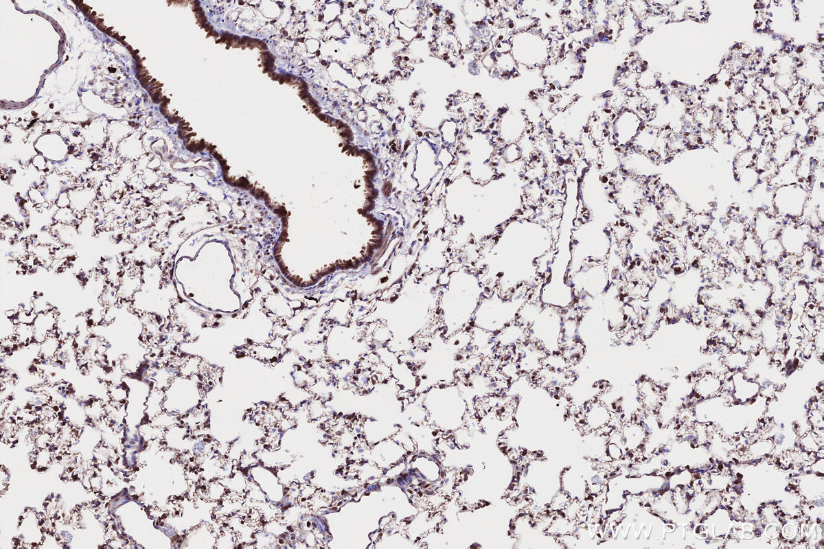 Immunohistochemical analysis of paraffin-embedded rat lung tissue slide using KHC2658 (CKAP2L IHC Kit).