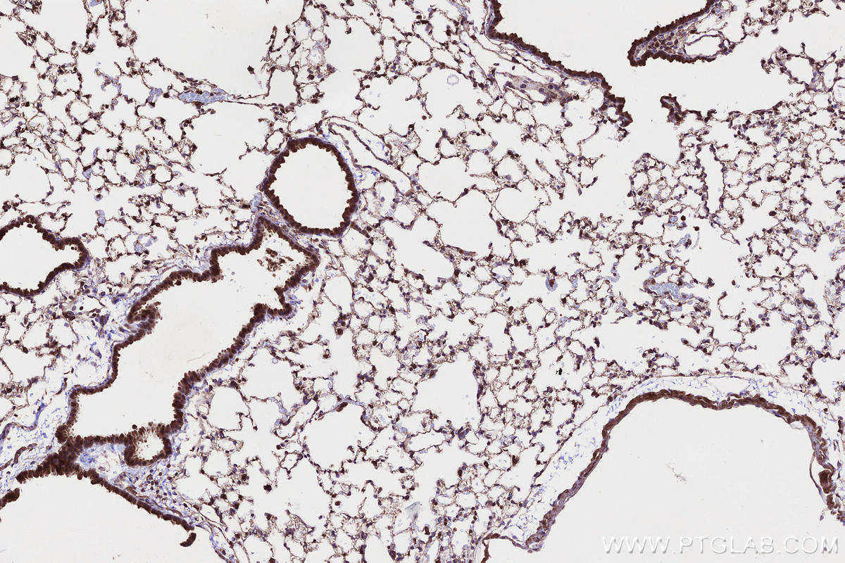 Immunohistochemical analysis of paraffin-embedded mouse lung tissue slide using KHC2658 (CKAP2L IHC Kit).