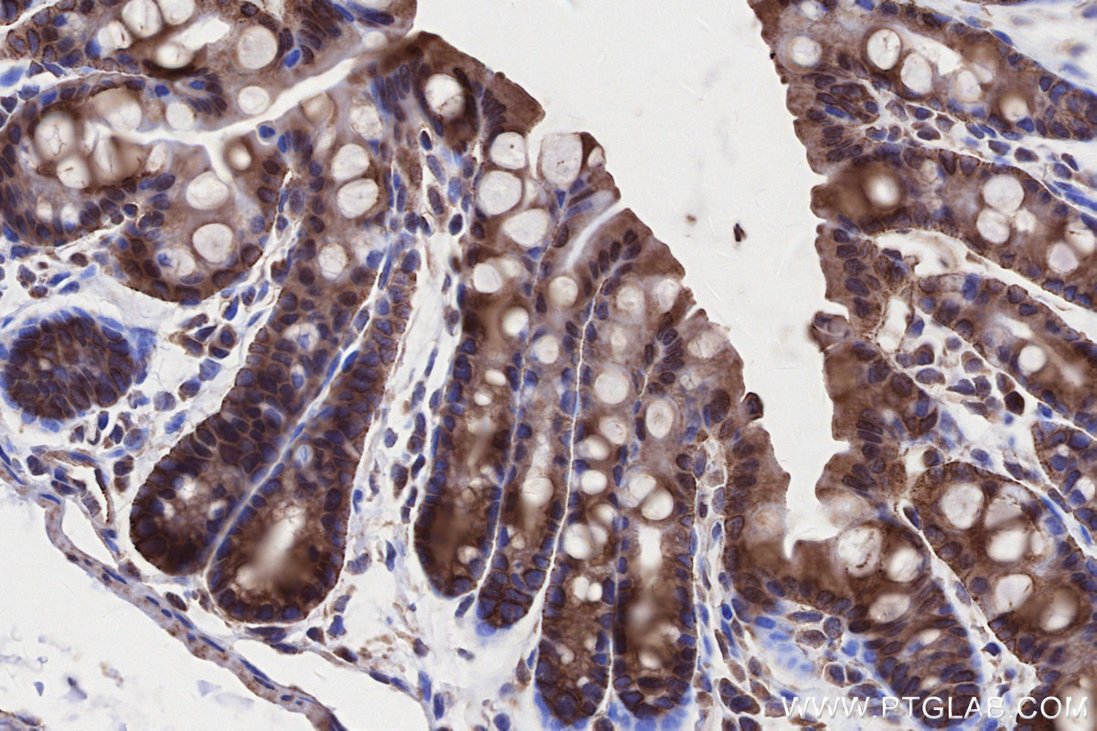 Immunohistochemical analysis of paraffin-embedded mouse colon tissue slide using KHC2658 (CKAP2L IHC Kit).