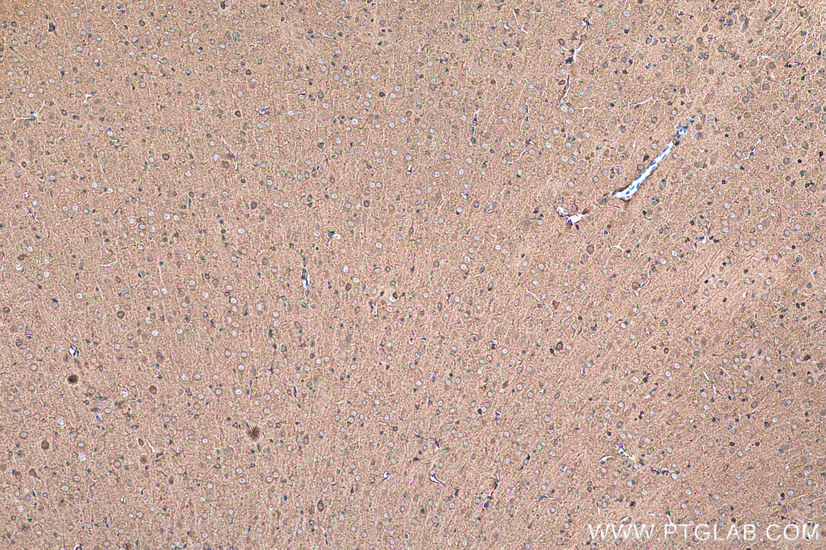 Immunohistochemical analysis of paraffin-embedded rat brain tissue slide using KHC0326 (CKB/CKM IHC Kit).