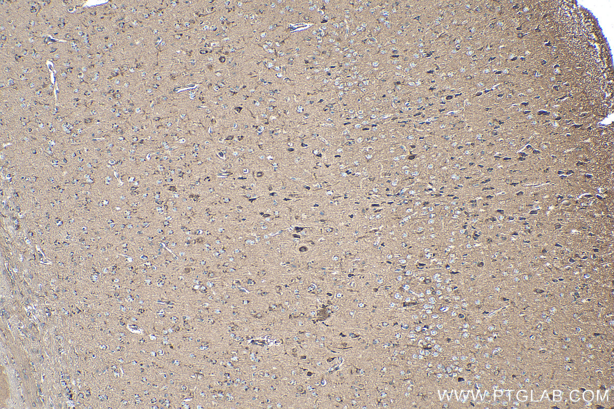 Immunohistochemical analysis of paraffin-embedded mouse brain tissue slide using KHC0325 (CKBB IHC Kit).