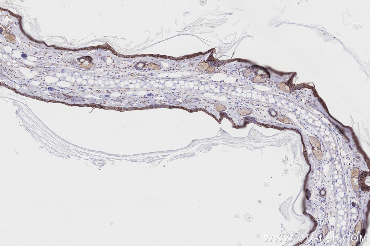 Immunohistochemical analysis of paraffin-embedded rat skin tissue slide using KHC3181 (CKMT1A IHC Kit).