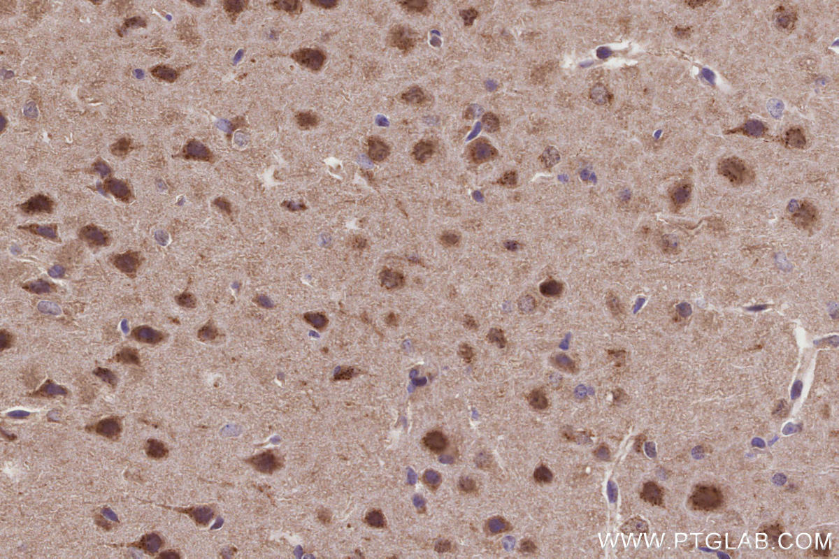 Immunohistochemical analysis of paraffin-embedded mouse brain tissue slide using KHC3223 (CLCN3 IHC Kit). Immunohistochemical analysis of paraffin-embedded mouse brain tissue slide using KHC3223 (CLCN3 IHC Kit).