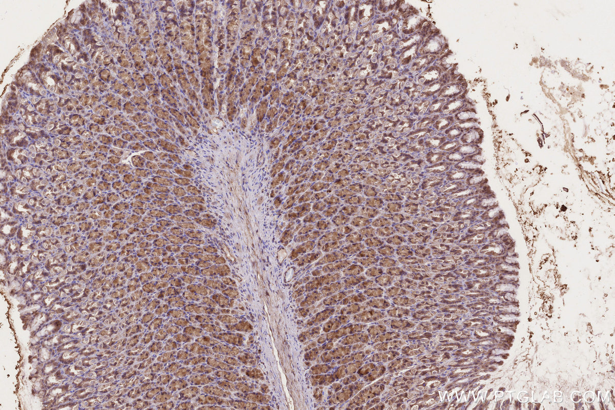 Immunohistochemical analysis of paraffin-embedded rat stomach tissue slide using KHC3223 (CLCN3 IHC Kit). Immunohistochemical analysis of paraffin-embedded rat stomach tissue slide using KHC3223 (CLCN3 IHC Kit).