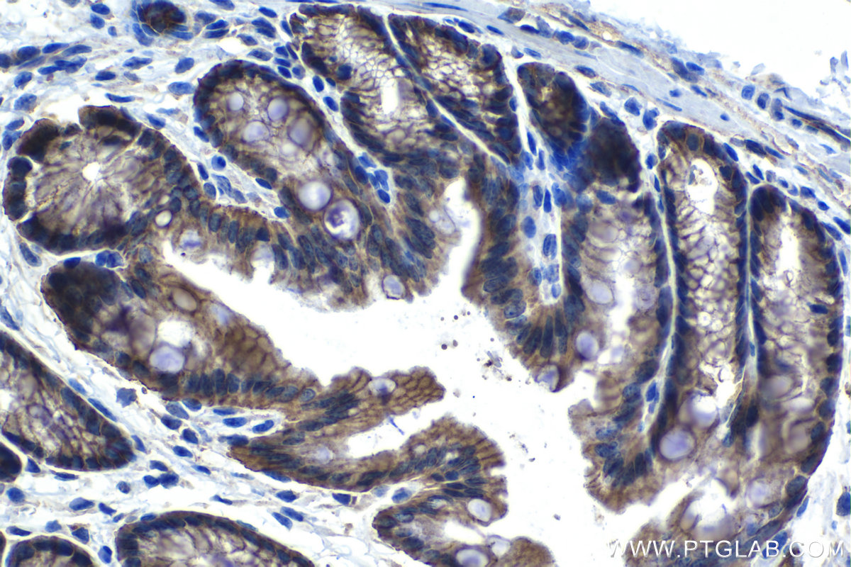 Immunohistochemical analysis of paraffin-embedded mouse colon tissue slide using KHC1317 (CLDN5 IHC Kit).