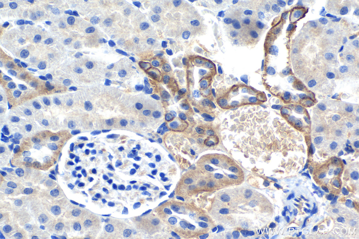 Immunohistochemical analysis of paraffin-embedded rat kidney tissue slide using KHC1318 (CLDN7 IHC Kit).