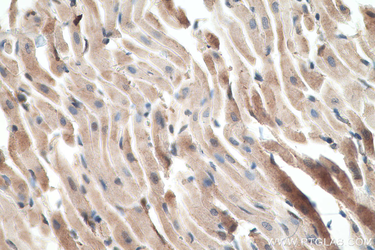 Immunohistochemical analysis of paraffin-embedded rat heart tissue slide using KHC0725 (CLIC1 IHC Kit).