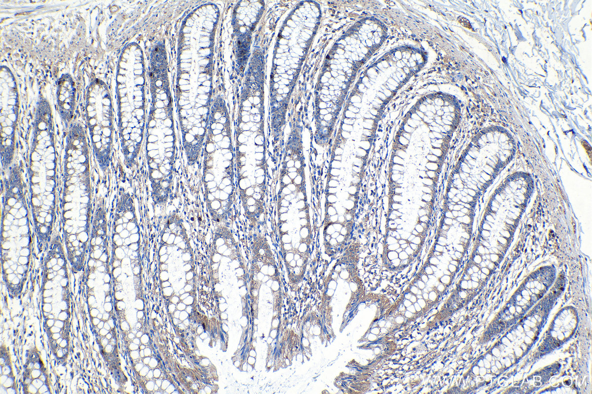 Immunohistochemical analysis of paraffin-embedded human colon tissue slide using KHC1272 (CLIP2 IHC Kit).