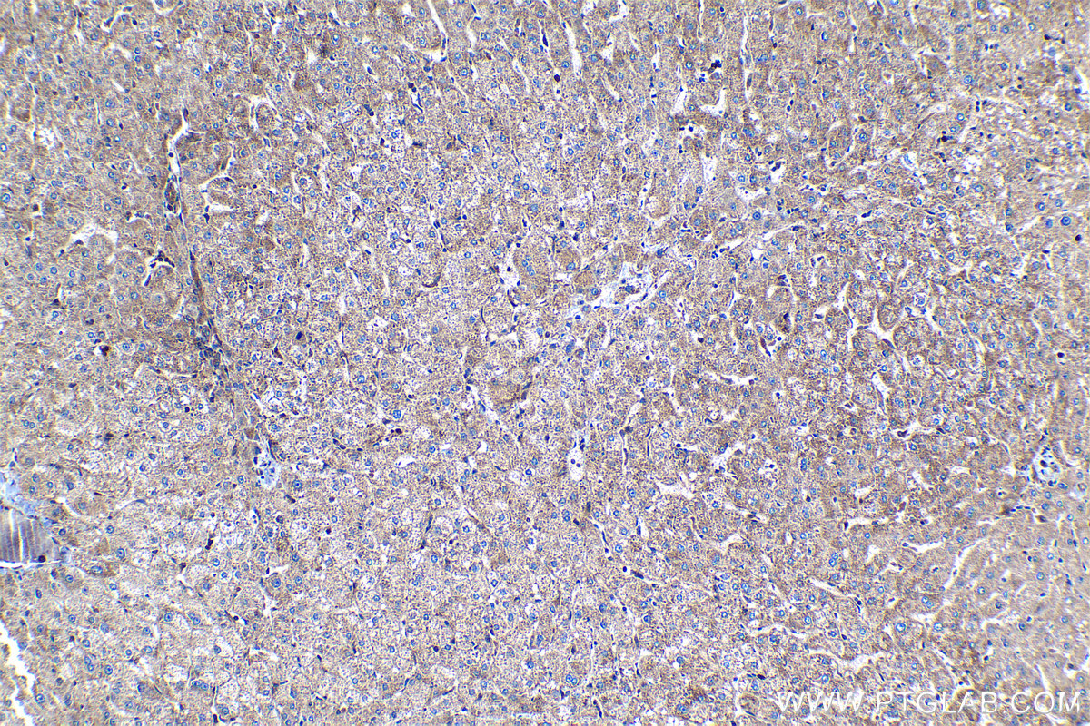 Immunohistochemical analysis of paraffin-embedded human liver tissue slide using KHC1272 (CLIP2 IHC Kit).