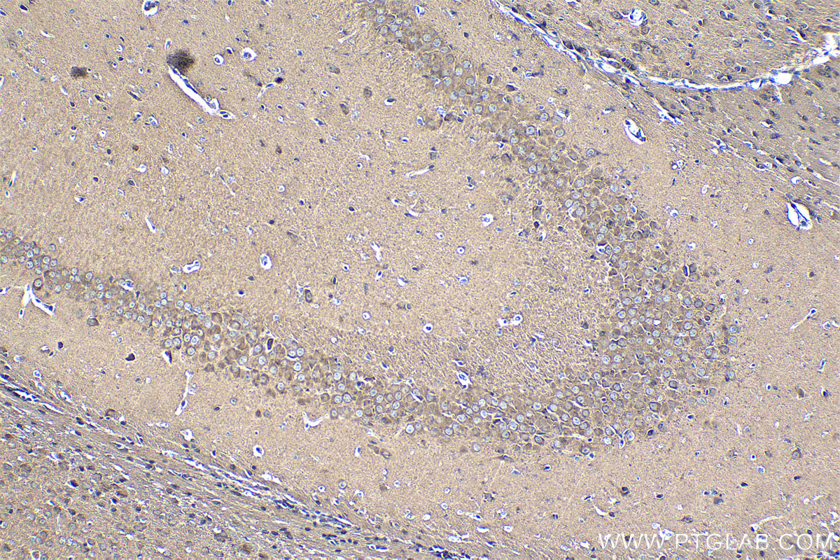 Immunohistochemical analysis of paraffin-embedded mouse brain tissue slide using KHC1272 (CLIP2 IHC Kit).