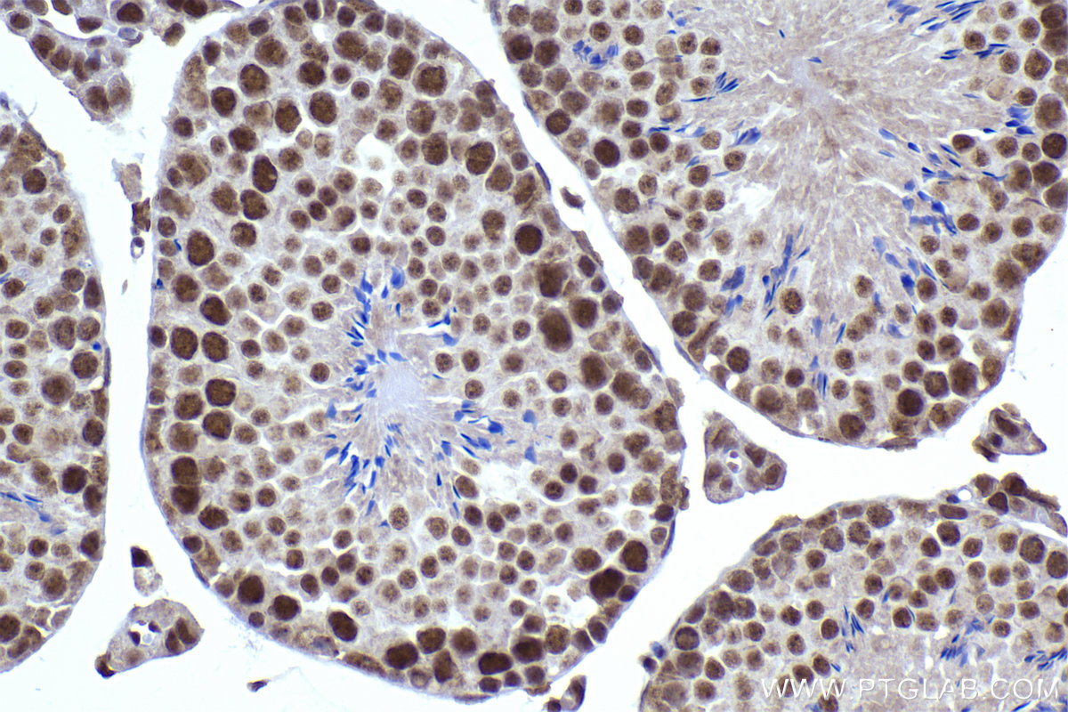Immunohistochemical analysis of paraffin-embedded mouse testis tissue slide using KHC2290 (CLK3 IHC Kit).