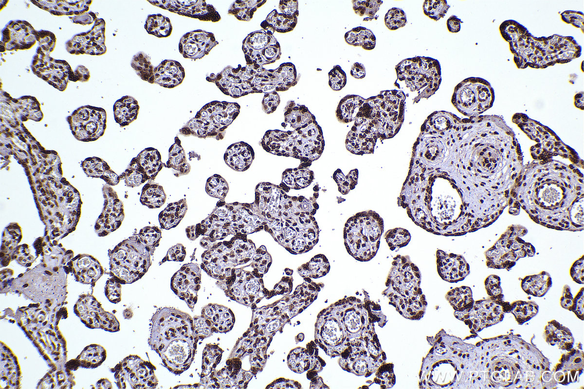 Immunohistochemical analysis of paraffin-embedded human placenta tissue slide using KHC2290 (CLK3 IHC Kit).