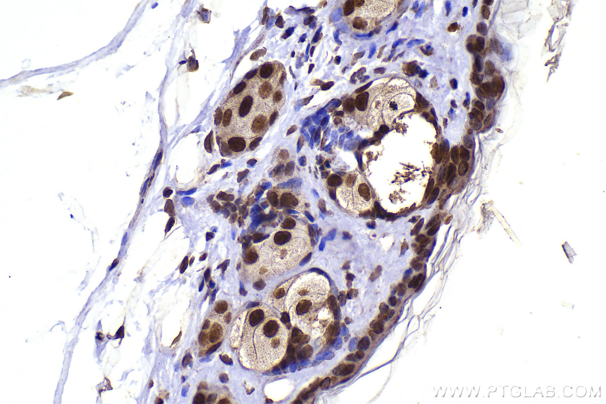Immunohistochemical analysis of paraffin-embedded mouse skin tissue slide using KHC2290 (CLK3 IHC Kit).