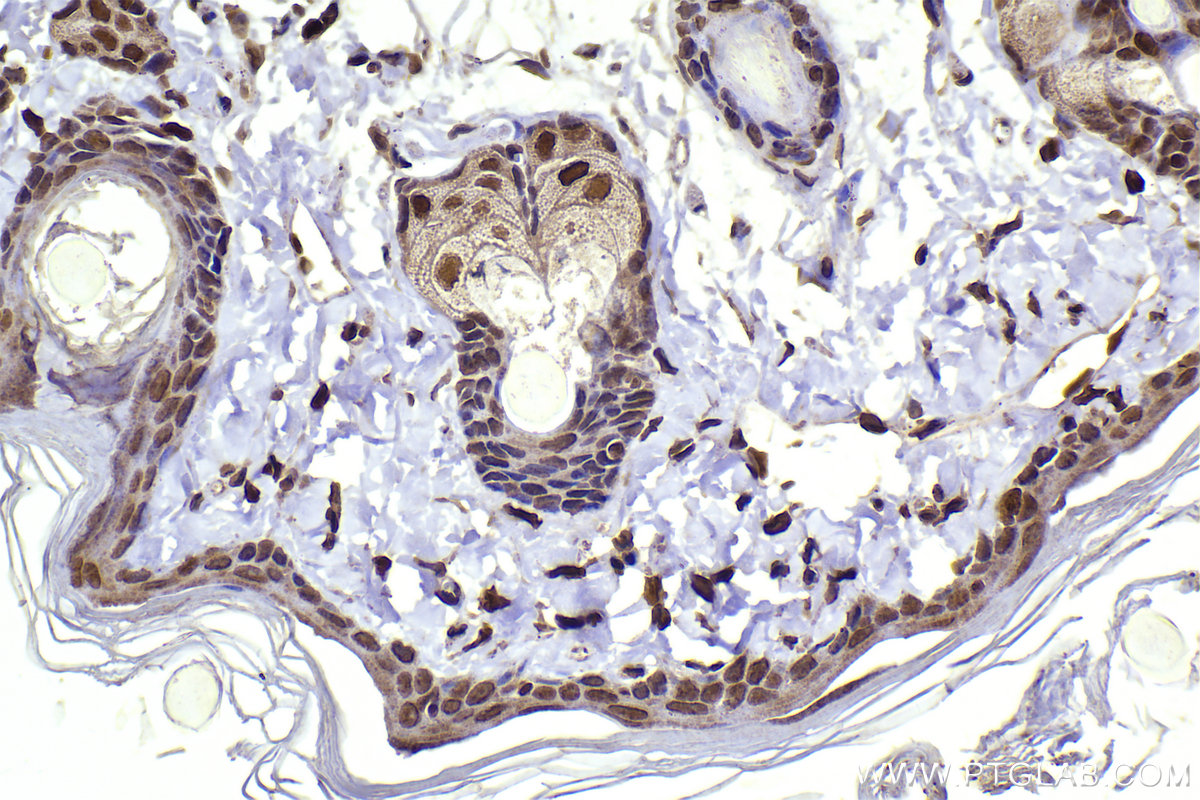 Immunohistochemical analysis of paraffin-embedded rat skin tissue slide using KHC2290 (CLK3 IHC Kit).