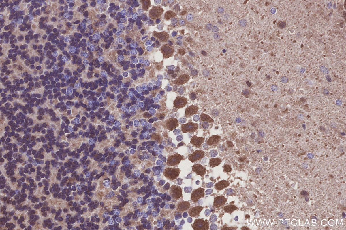 Immunohistochemical analysis of paraffin-embedded mouse cerebellum tissue slide using KHC3250 (CLN3 IHC Kit). Immunohistochemical analysis of paraffin-embedded mouse cerebellum tissue slide using KHC3250 (CLN3 IHC Kit).