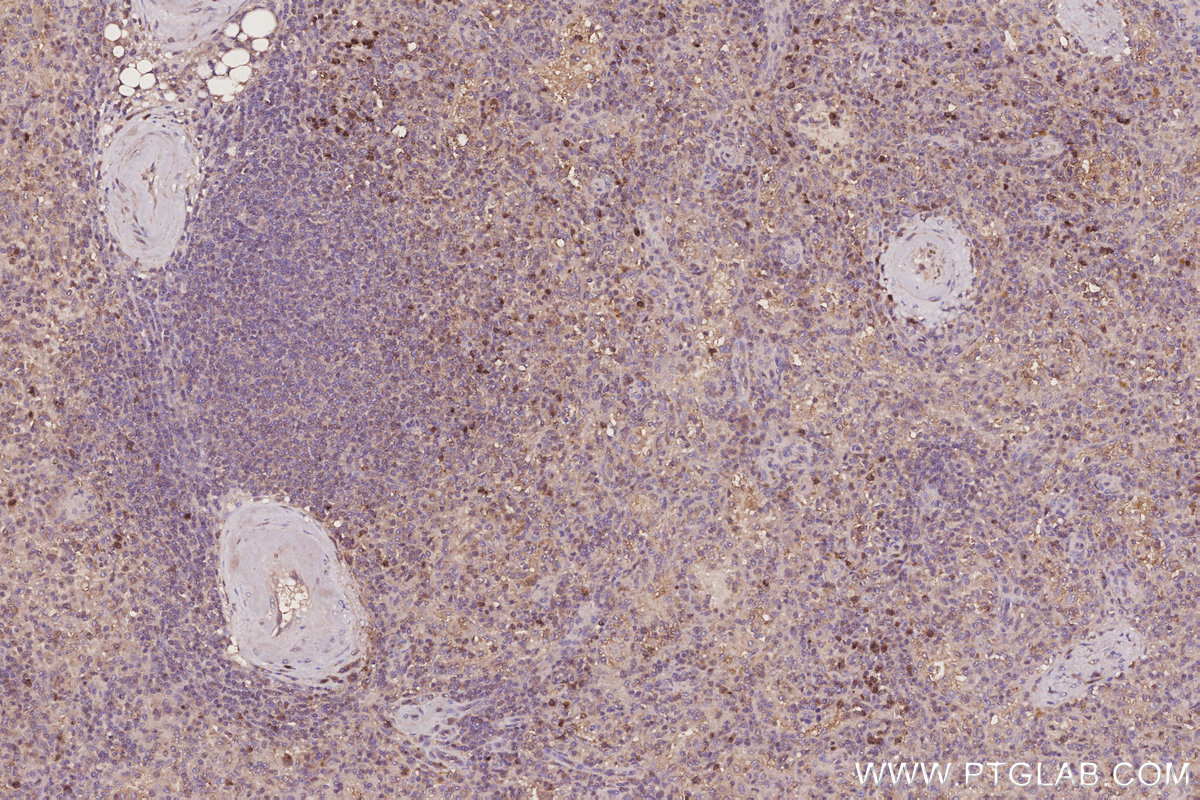 Immunohistochemical analysis of paraffin-embedded human spleen tissue slide using KHC3250 (CLN3 IHC Kit). Immunohistochemical analysis of paraffin-embedded human spleen tissue slide using KHC3250 (CLN3 IHC Kit).