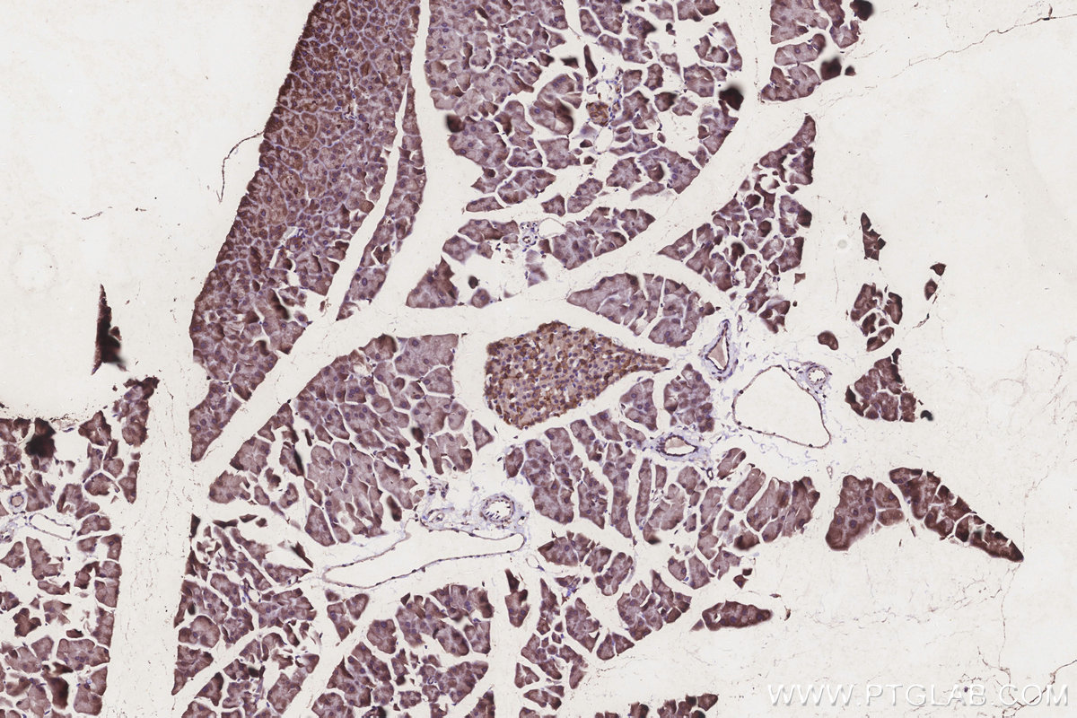 Immunohistochemical analysis of paraffin-embedded mouse pancreas tissue slide using KHC3250 (CLN3 IHC Kit). Immunohistochemical analysis of paraffin-embedded mouse pancreas tissue slide using KHC3250 (CLN3 IHC Kit).