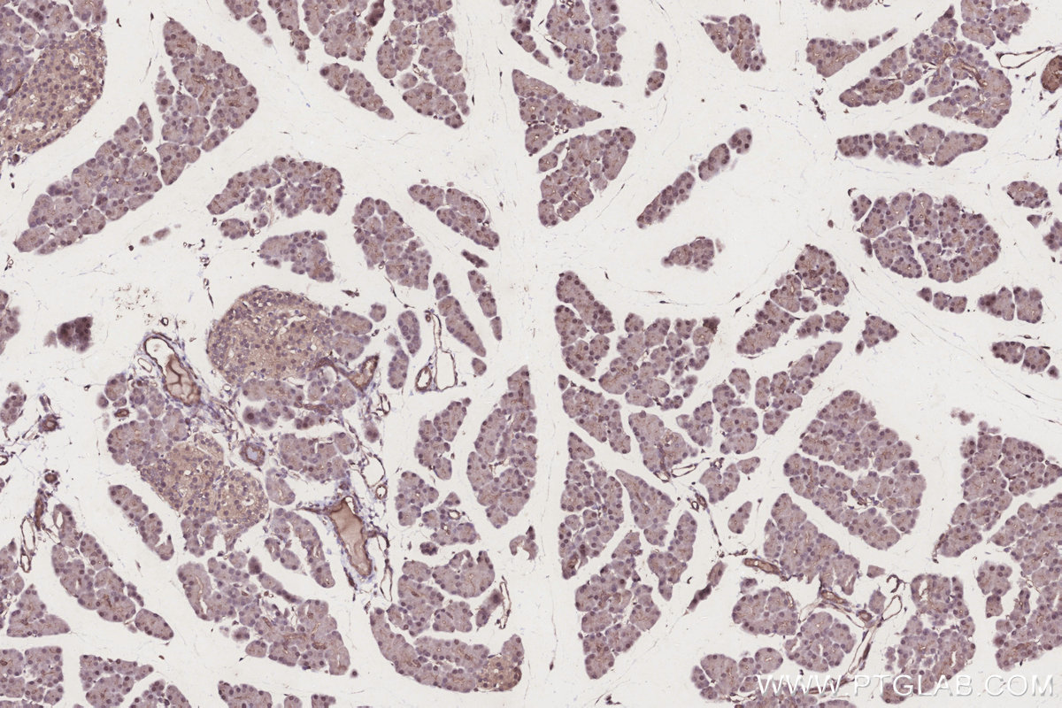 Immunohistochemical analysis of paraffin-embedded rat pancreas tissue slide using KHC3250 (CLN3 IHC Kit). Immunohistochemical analysis of paraffin-embedded rat pancreas tissue slide using KHC3250 (CLN3 IHC Kit).