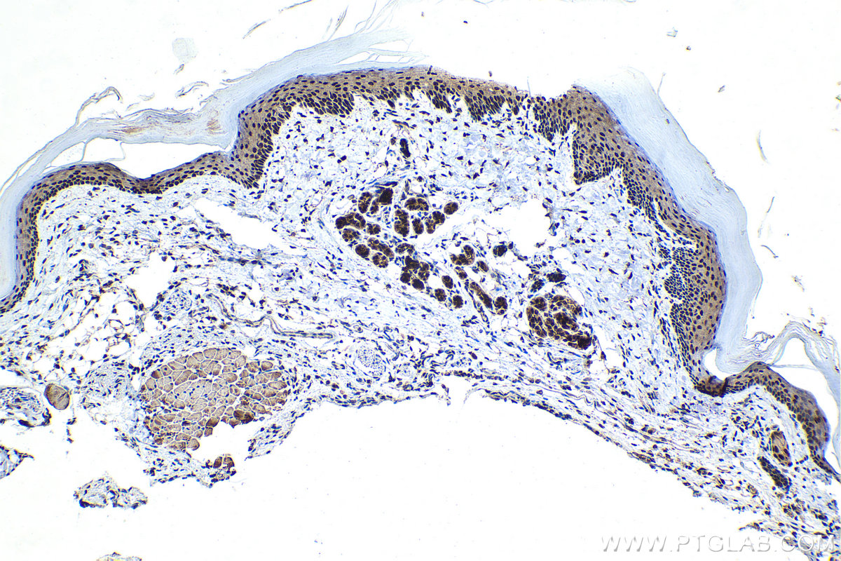 Immunohistochemical analysis of paraffin-embedded mouse skin tissue slide using KHC1447 (CLOCK IHC Kit).