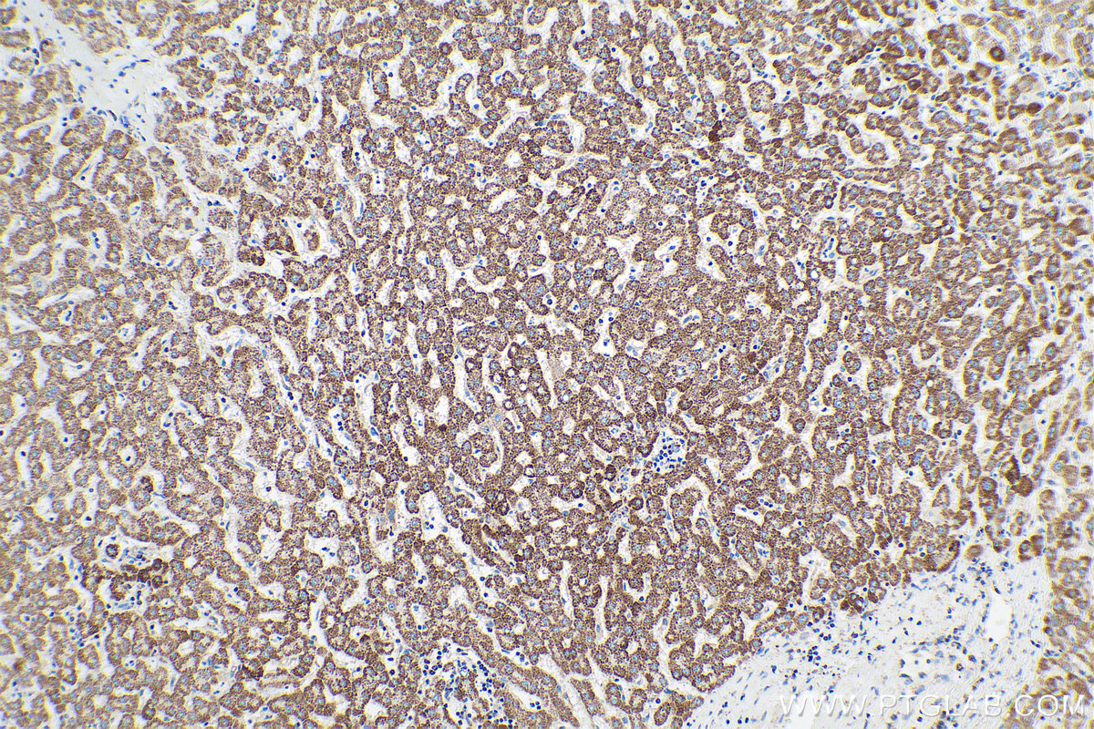 Immunohistochemical analysis of paraffin-embedded human liver tissue slide using KHC0816 (CLPP IHC Kit).