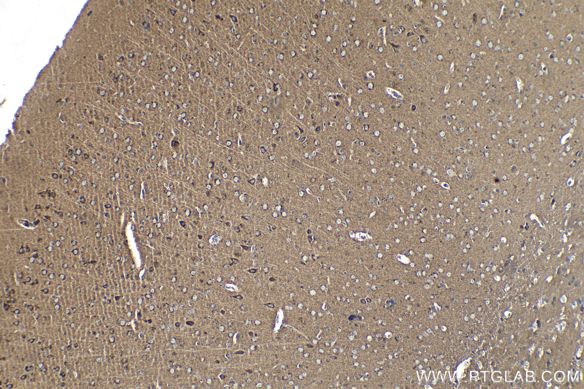 Immunohistochemical analysis of paraffin-embedded mouse brain tissue slide using KHC1359 (CLSTN1 IHC Kit).