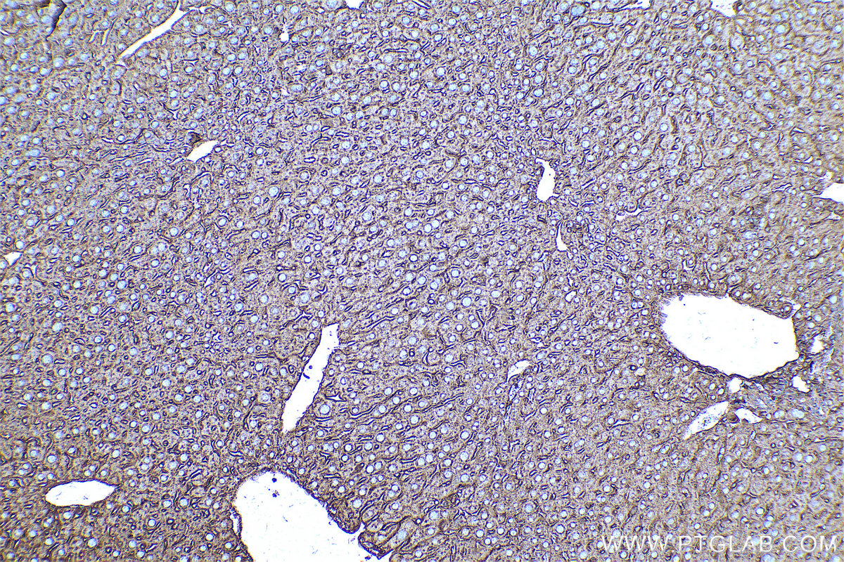 Immunohistochemical analysis of paraffin-embedded mouse liver tissue slide using KHC0592 (CLTA IHC Kit).