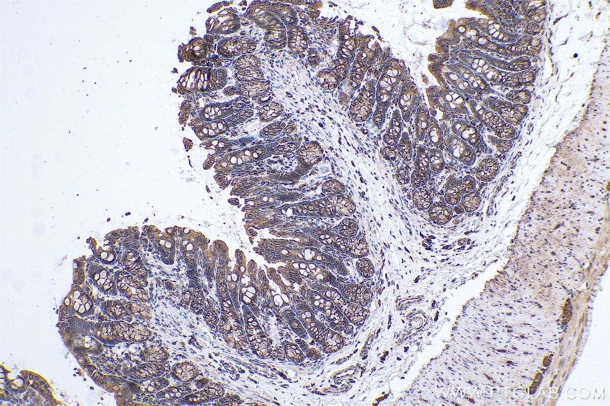 Immunohistochemical analysis of paraffin-embedded rat colon tissue slide using KHC0687 (CLTC IHC Kit).