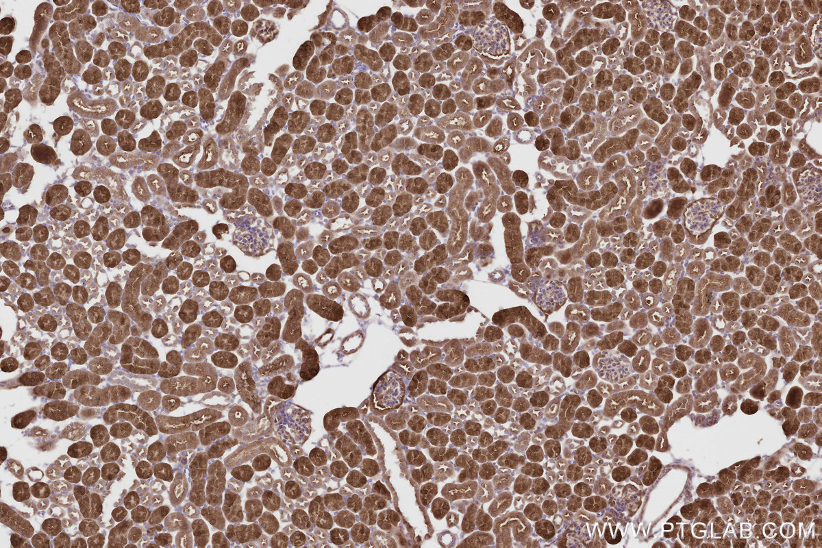Immunohistochemical analysis of paraffin-embedded mouse kidney tissue slide using KHC2804 (CNDP2 IHC Kit).