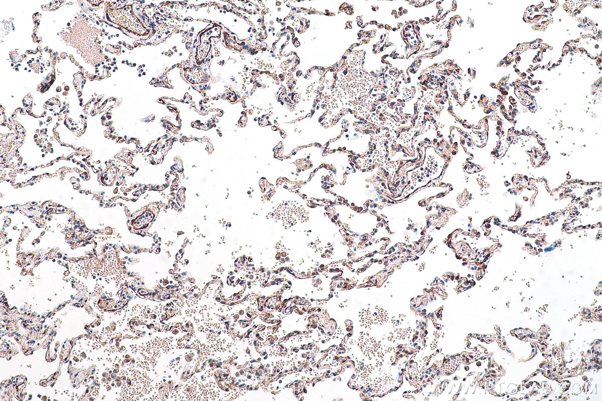 Immunohistochemical analysis of paraffin-embedded human lung tissue slide using KHC0892 (CNN3 IHC Kit).