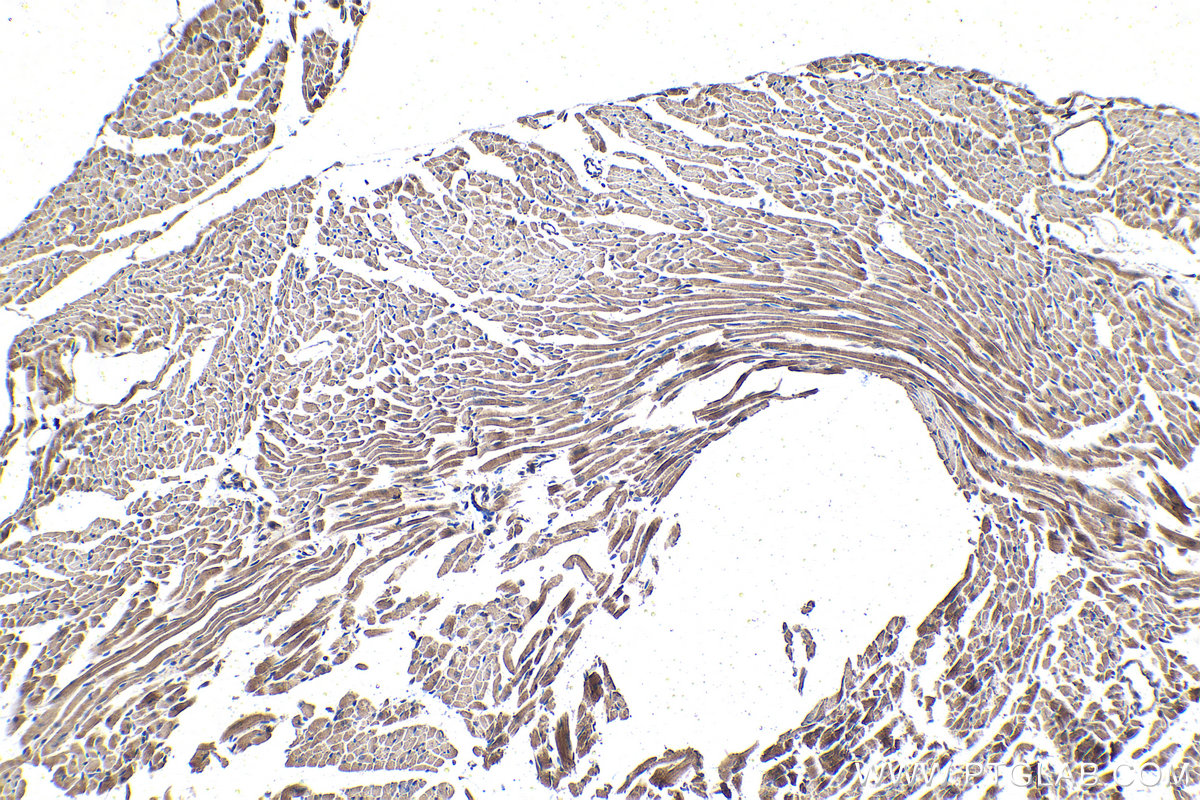 Immunohistochemical analysis of paraffin-embedded mouse heart tissue slide using KHC1415 (CNOT1 IHC Kit).