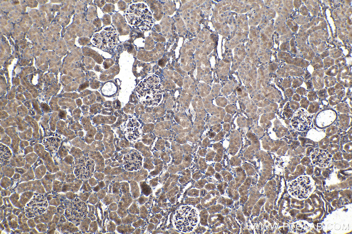 Immunohistochemical analysis of paraffin-embedded rat kidney tissue slide using KHC1415 (CNOT1 IHC Kit).