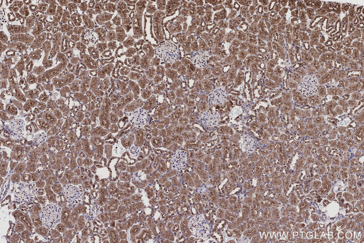 Immunohistochemical analysis of paraffin-embedded rat kidney tissue slide using KHC2925 (CNOT10 IHC Kit).