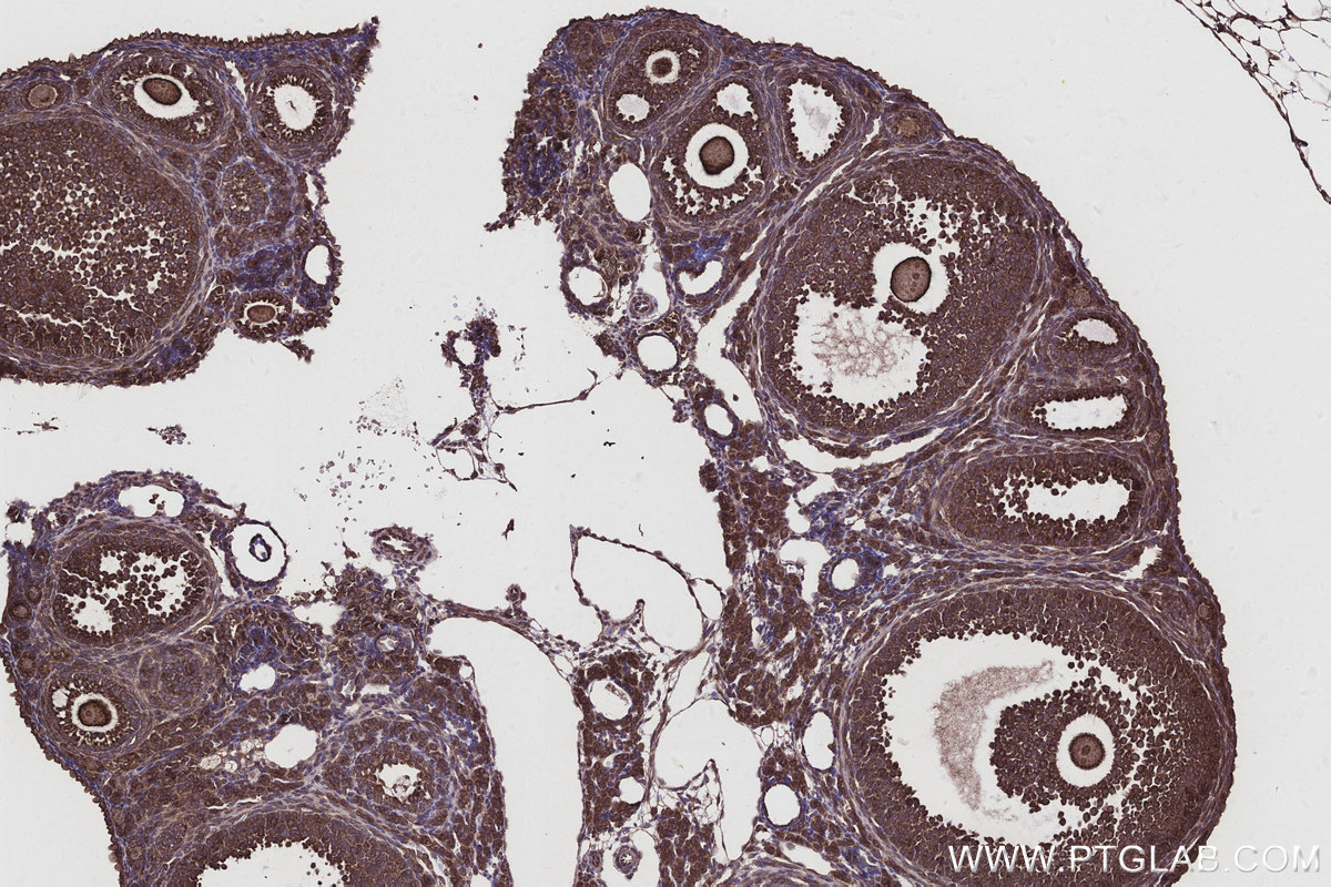 Immunohistochemical analysis of paraffin-embedded mouse ovary tissue slide using KHC2925 (CNOT10 IHC Kit).