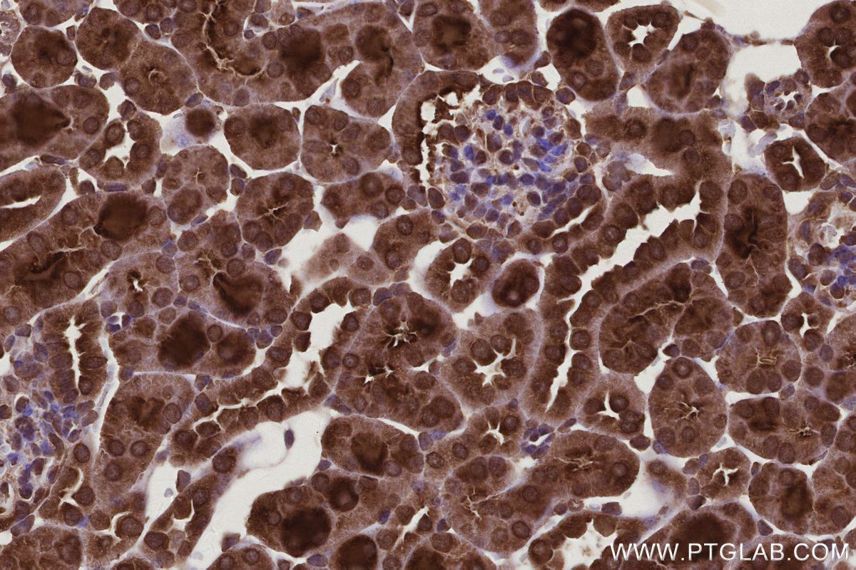 Immunohistochemical analysis of paraffin-embedded mouse kidney tissue slide using KHC2925 (CNOT10 IHC Kit).