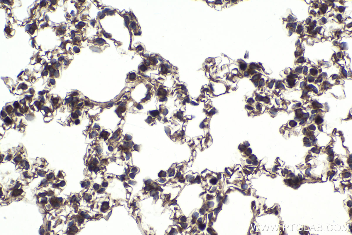 Immunohistochemical analysis of paraffin-embedded mouse lung tissue slide using KHC1973 (CNOT2 IHC Kit).