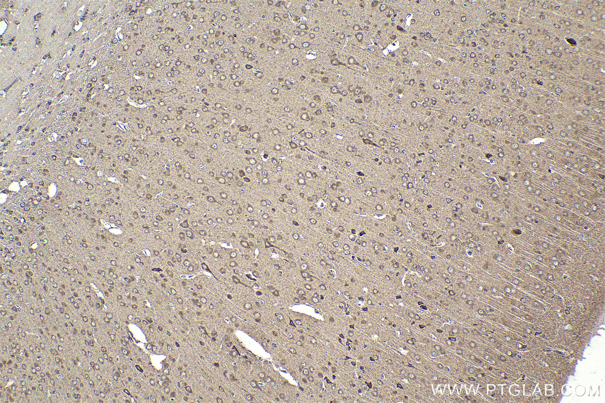 Immunohistochemical analysis of paraffin-embedded mouse brain tissue slide using KHC1973 (CNOT2 IHC Kit).