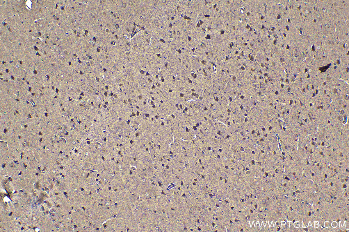 Immunohistochemical analysis of paraffin-embedded rat brain tissue slide using KHC1471 (CNOT3 IHC Kit).