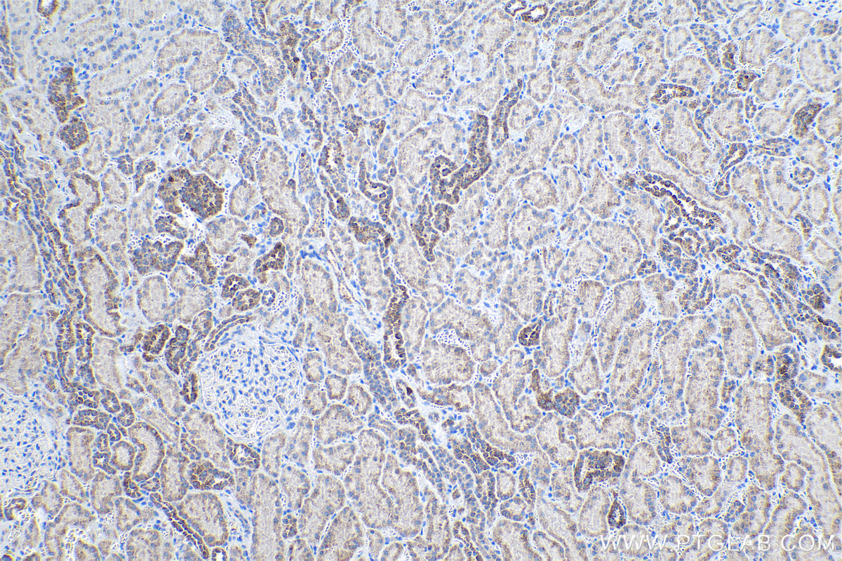 Immunohistochemical analysis of paraffin-embedded human kidney tissue slide using KHC1023 (COA6 IHC Kit).