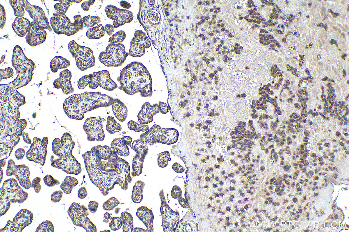 Immunohistochemical analysis of paraffin-embedded human placenta tissue slide using KHC0987 (COA7/C1orf163 IHC Kit).