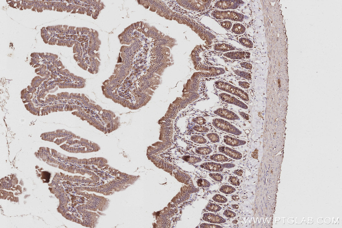 Immunohistochemical analysis of paraffin-embedded rat small intestine tissue slide using KHC3046 (COG5 IHC Kit).