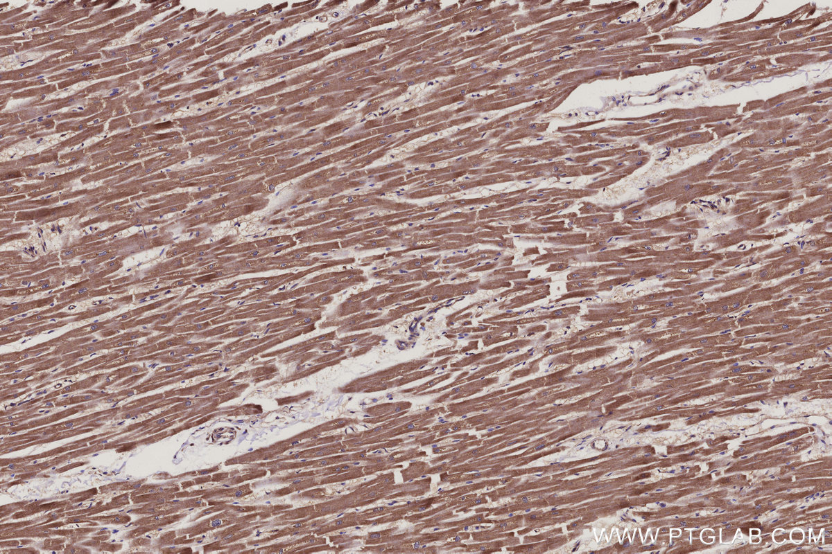 Immunohistochemical analysis of paraffin-embedded human heart tissue slide using KHC3117 (COMMD5 IHC Kit). Immunohistochemical analysis of paraffin-embedded human heart tissue slide using KHC3117 (COMMD5 IHC Kit).