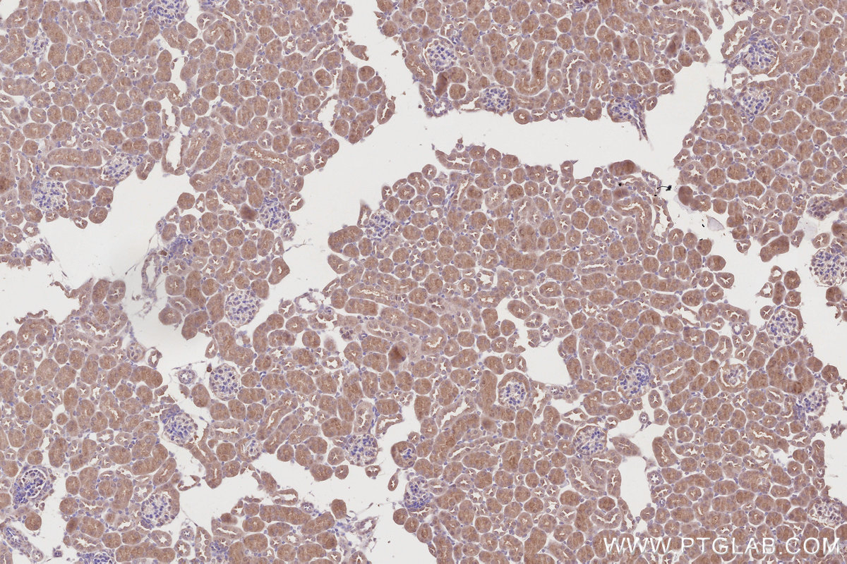 Immunohistochemical analysis of paraffin-embedded mouse kidney tissue slide using KHC2864 (COPS4 IHC Kit).