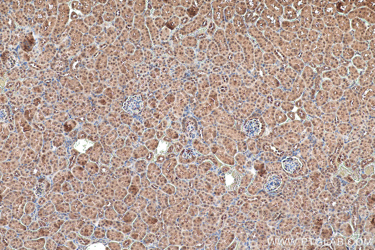 Immunohistochemical analysis of paraffin-embedded mouse kidney tissue slide using KHC0921 (COPS5/JAB1 IHC Kit).